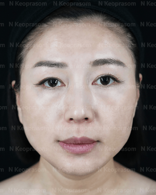 PROVEN RESULTS after