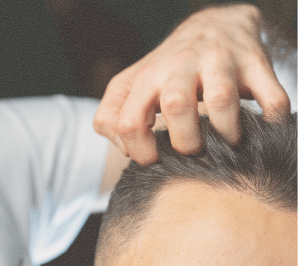 Scalp condition assessment