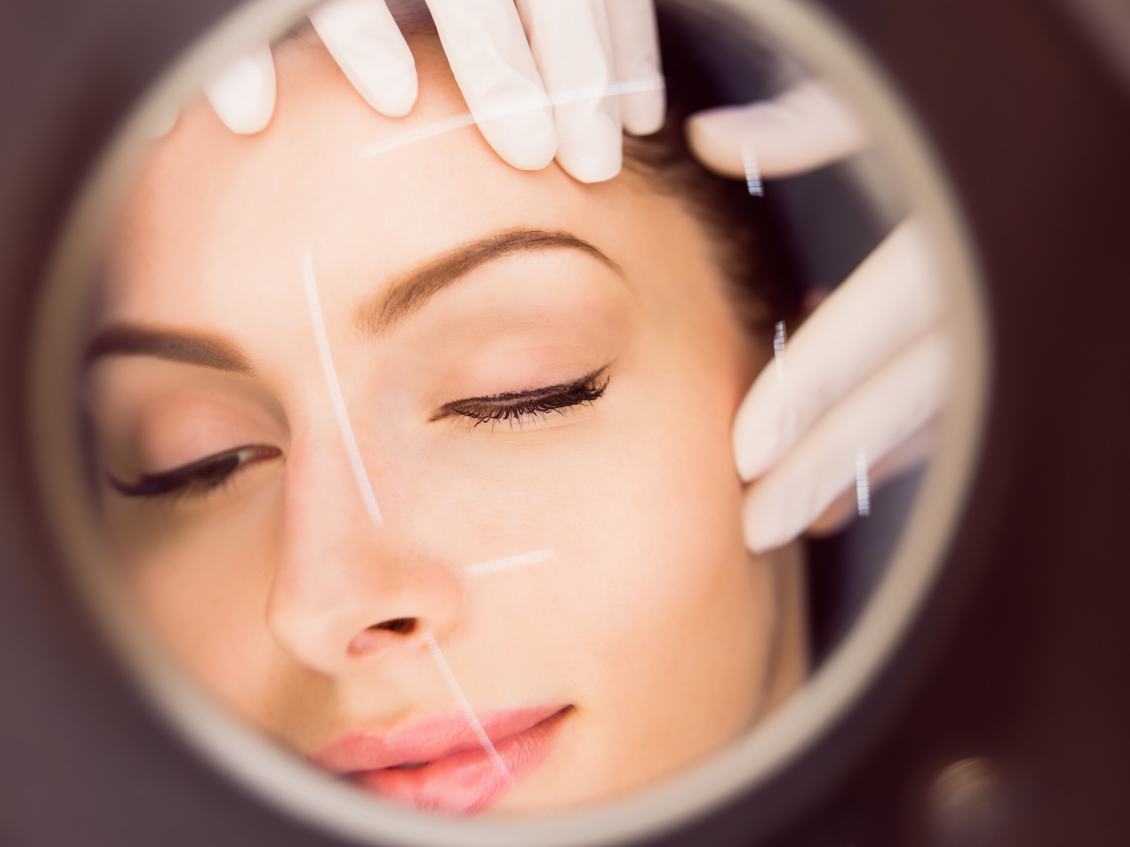 ProDeep® Laser treatment