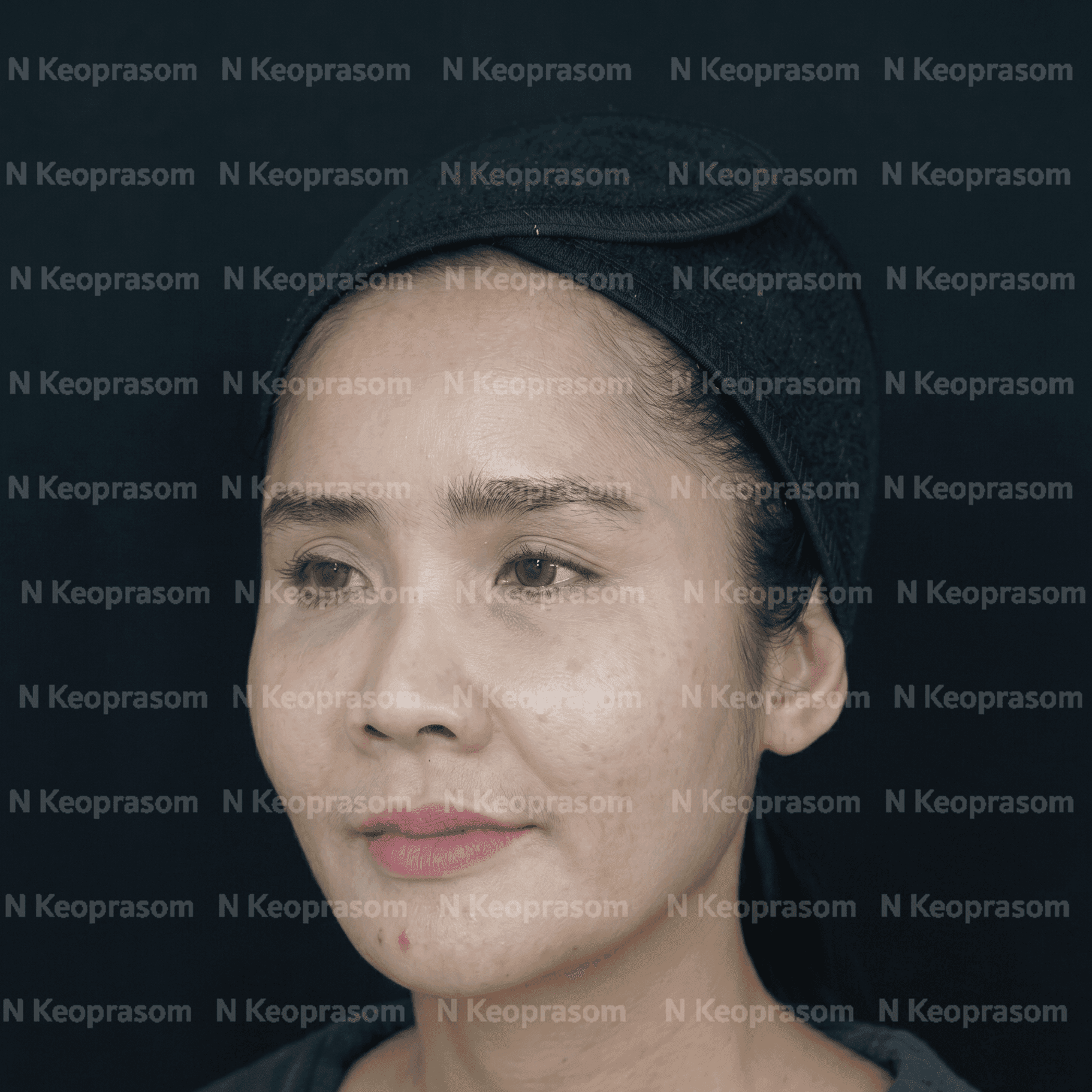 Before treatment result