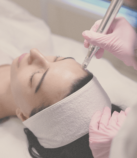 MesoJet facial treatment