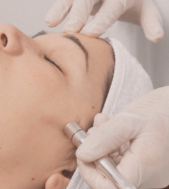 MesoJet skin treatment