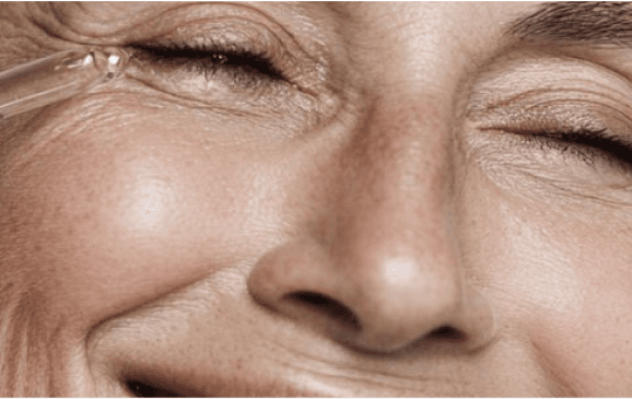ผลลัพธ์ Skin Tightening หลังทำเลเซอร์ยกกระชับ