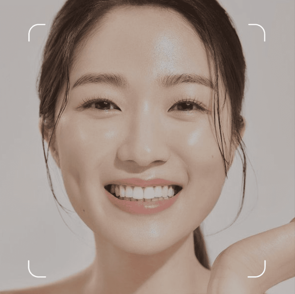 ACNE TREATMENT