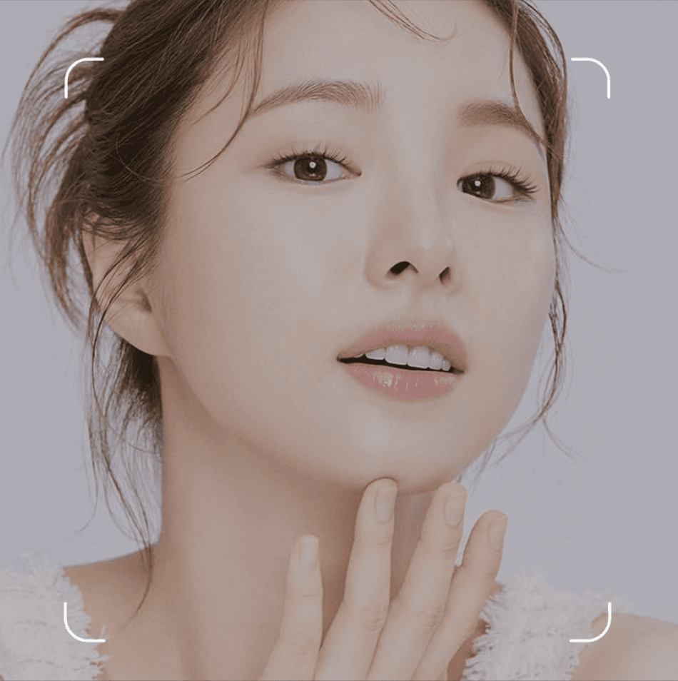 MELASMA & FRECKLES TREATMENT